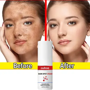 Dark Spot Repair Crema Este Folosit Pentru A Se Estompeze Pete De Lumina Tonul Pielii, Reduce Liniile Fine De Albire Eliminarea Melanina Crema Faciala